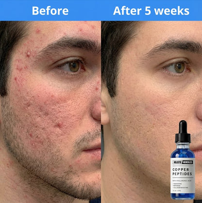 GHK-Cu Peptides Serum